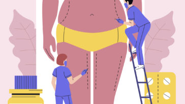 Weight Loss Surgery Insurance