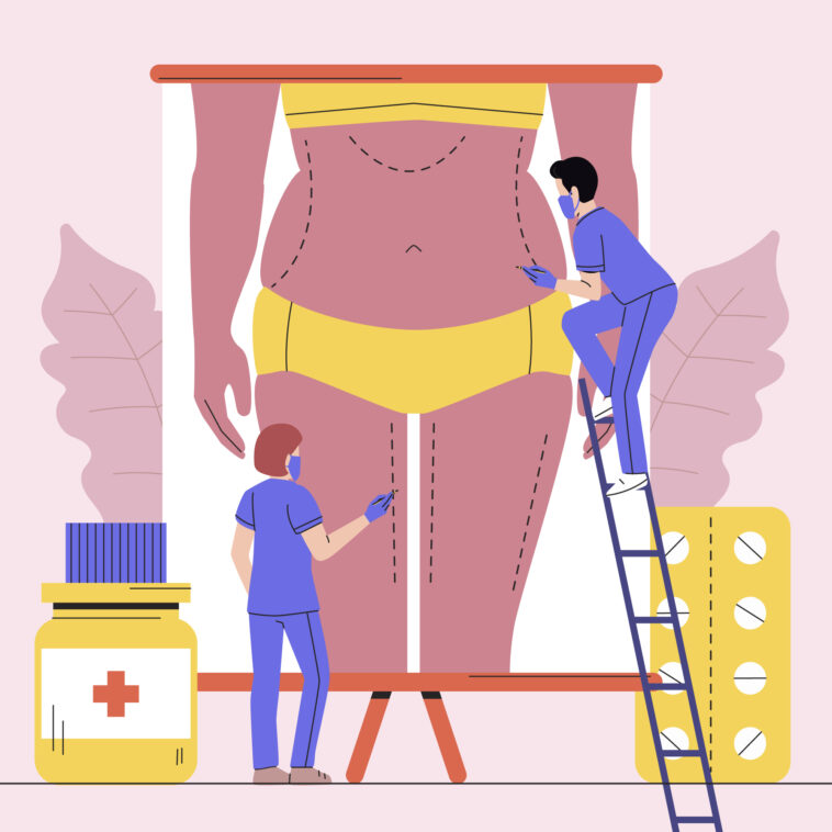 Weight Loss Surgery Insurance